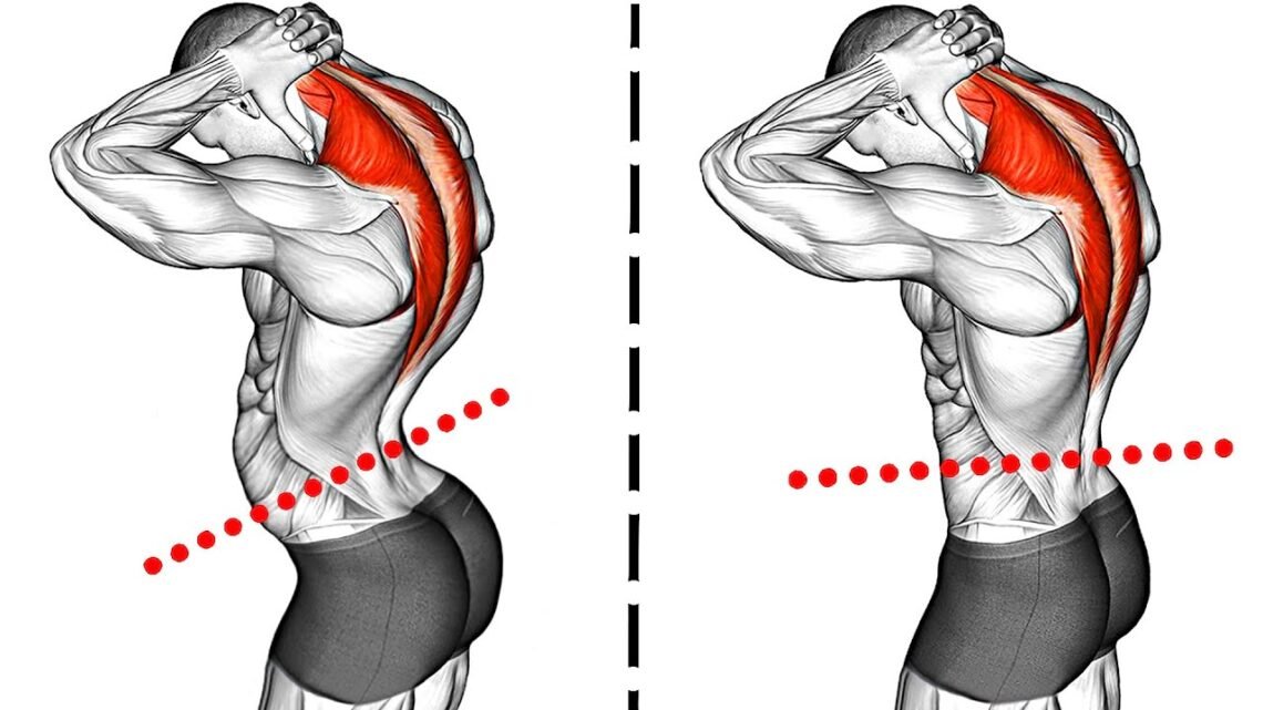 Fix Anterior Pelvic Tilt (Relieve Lower Back Pain)