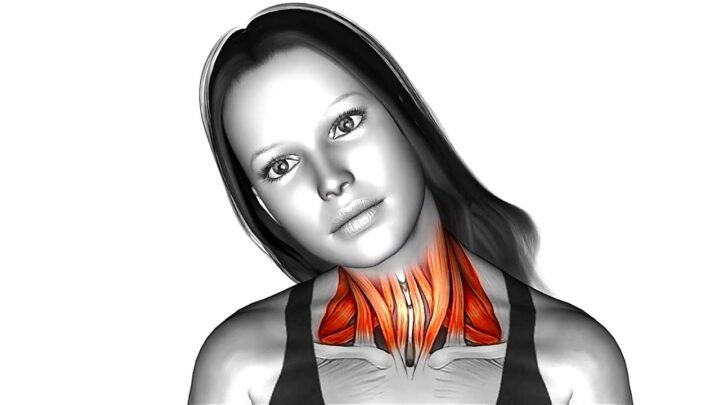 Best 10 Exercises for Neck Pain Relief and Cervical Spondylosis
