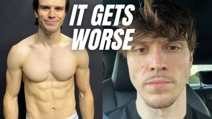 The dark side of losing weight… part 2